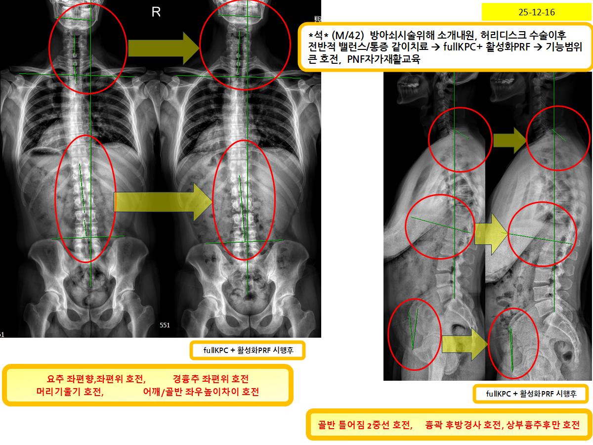 b48dedbc85ee1b291604e6d097f8ef0b_1766185466_2345.png