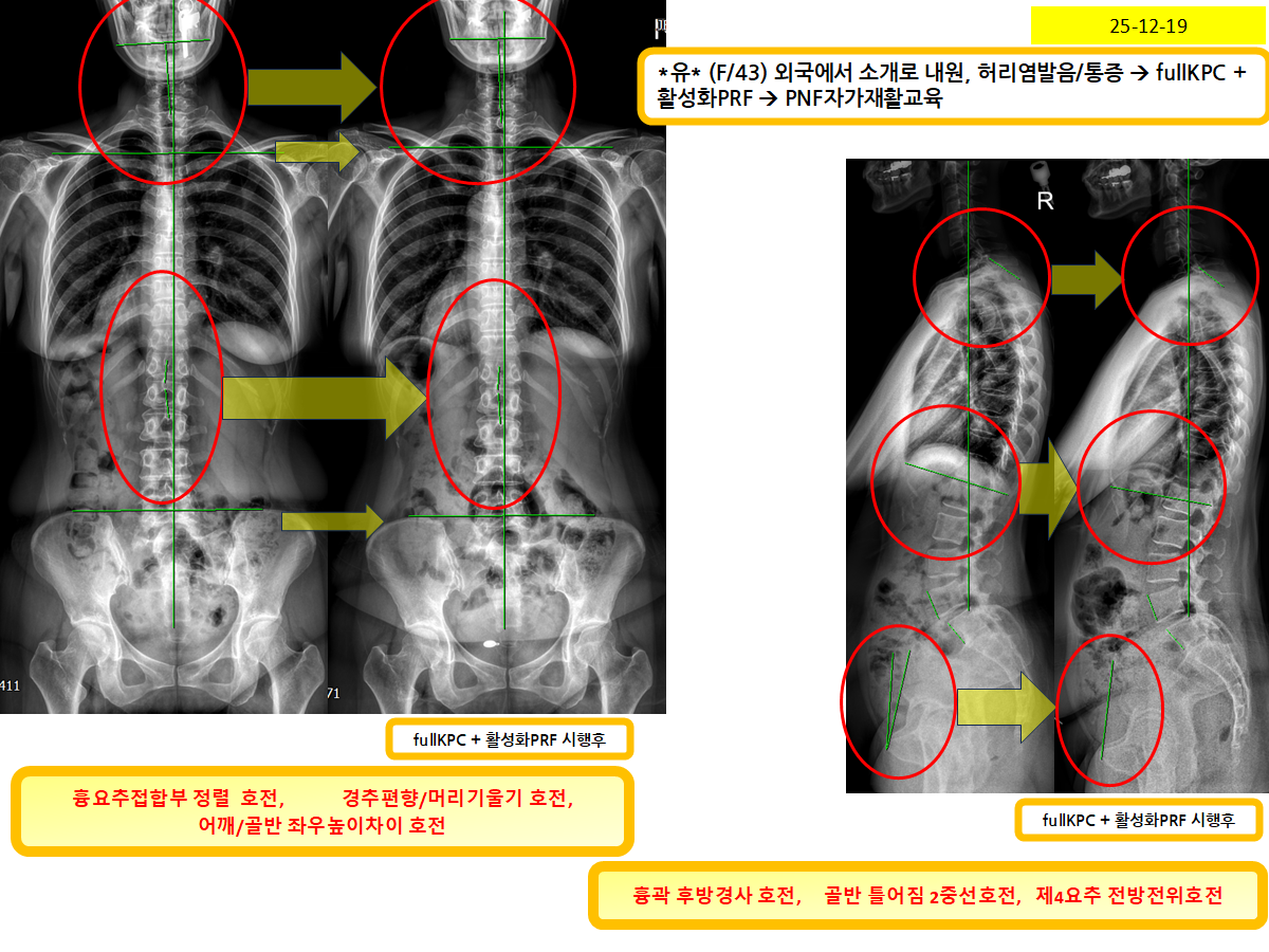 4cd50c95abfb4fc1d3ef41d256e79b69_1768009246_7976.png 4cd50c95abfb4fc1d3ef41d256e79b69_1768009246_7976.png