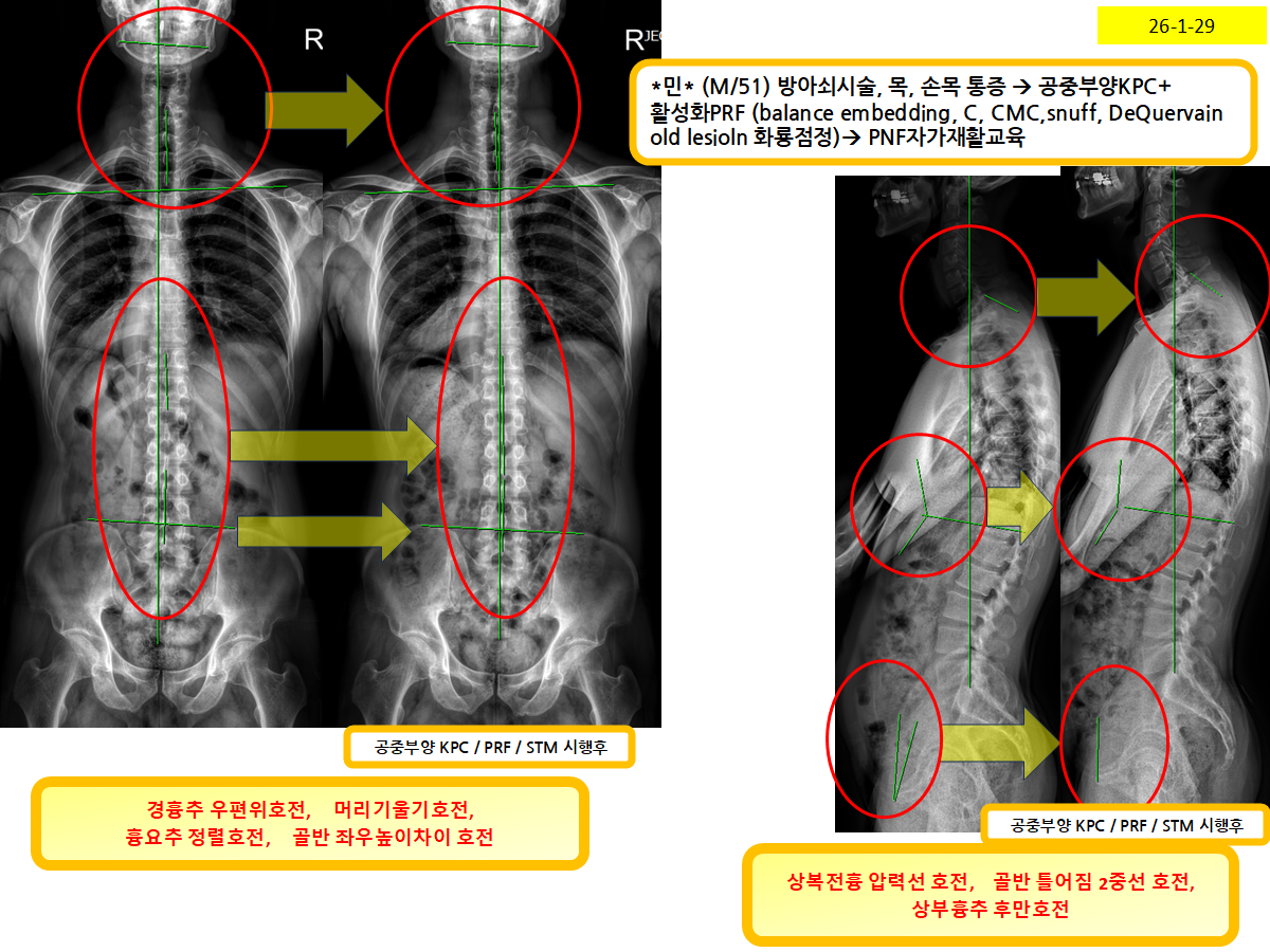 af8d5dce703399c074650ac5b0475d0e_1769826104_0742.png af8d5dce703399c074650ac5b0475d0e_1769826104_0742.png