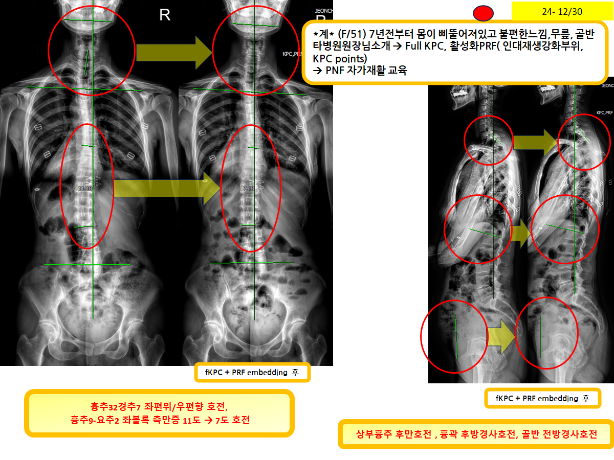 0ebd84477f293077f78d7a0cb2e630ed_1772167750_3399.png 0ebd84477f293077f78d7a0cb2e630ed_1772167750_3399.png