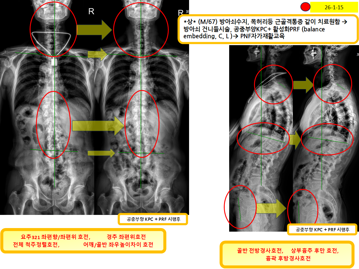 397bf174cfe2e29d0ac4f75f0653f706_1770868982_0888.png 397bf174cfe2e29d0ac4f75f0653f706_1770868982_0888.png