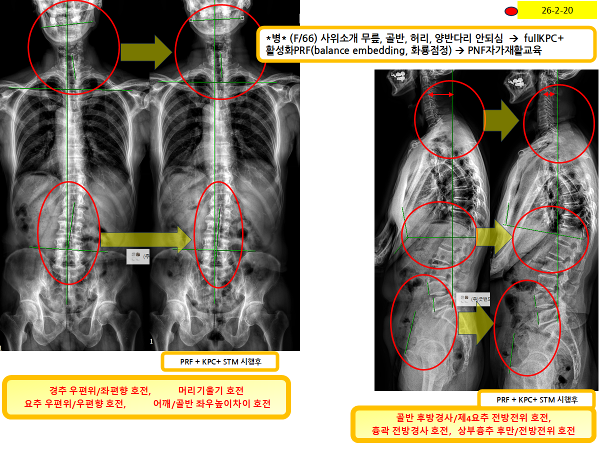3bdbce2007bcd12fb5a566a9fd0a5e70_1771911590_4081.png 3bdbce2007bcd12fb5a566a9fd0a5e70_1771911590_4081.png