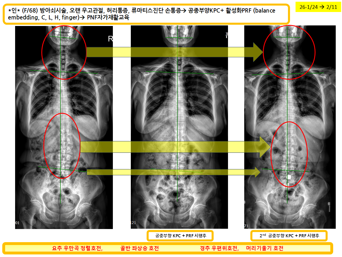 7daae232354cc4e81bcdae6f2bd97cd2_1771639006_8719.png 7daae232354cc4e81bcdae6f2bd97cd2_1771639006_8719.png