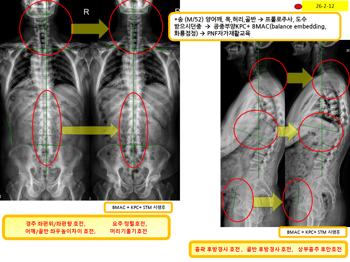 ad181e306bd62a6cfb4208abbe58130d_1771040596_9812.png ad181e306bd62a6cfb4208abbe58130d_1771040596_9812.png
