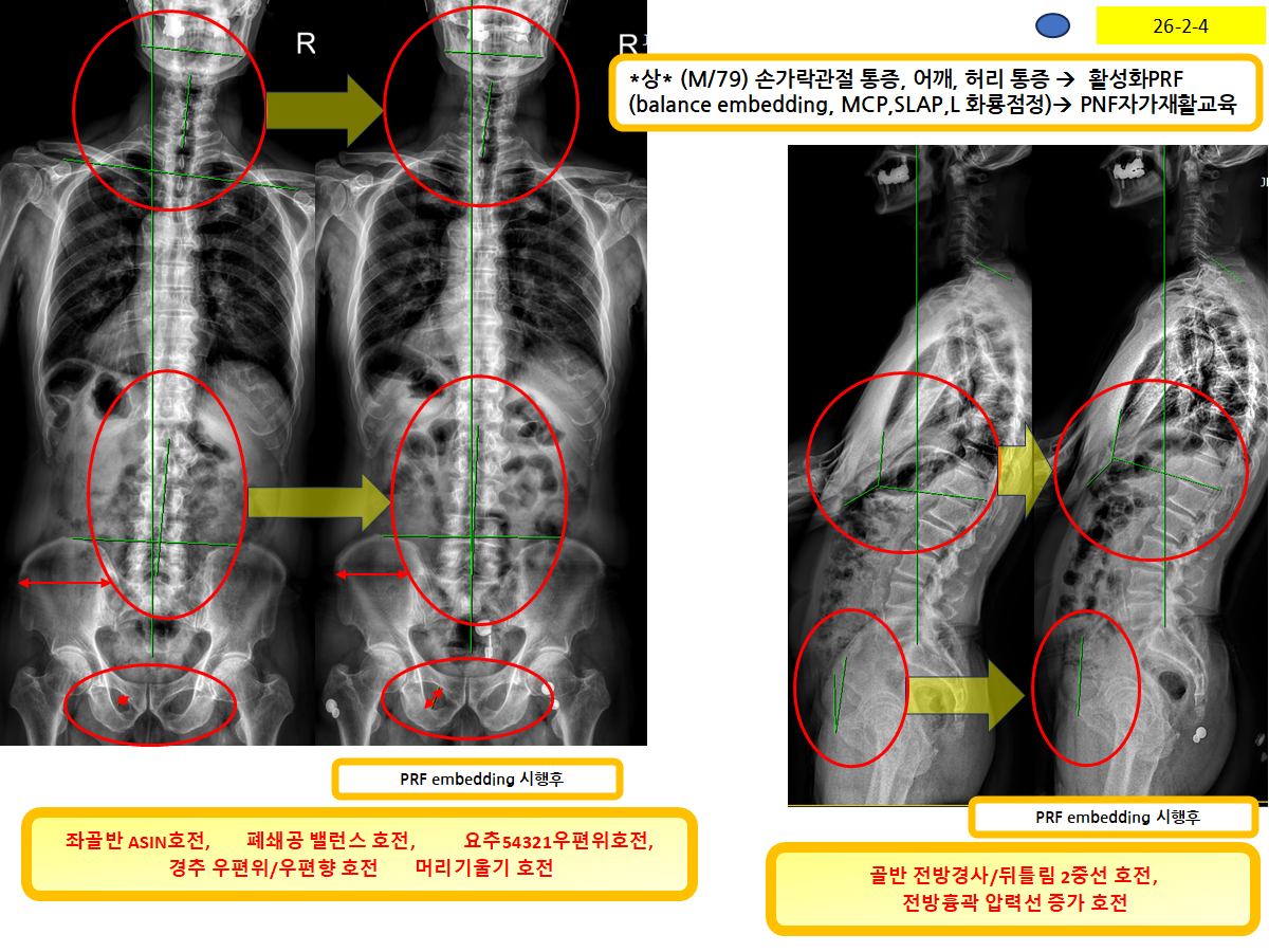 b4561ee6c991c2a9255e1760bf057e2d_1770260158_6142.png b4561ee6c991c2a9255e1760bf057e2d_1770260158_6142.png