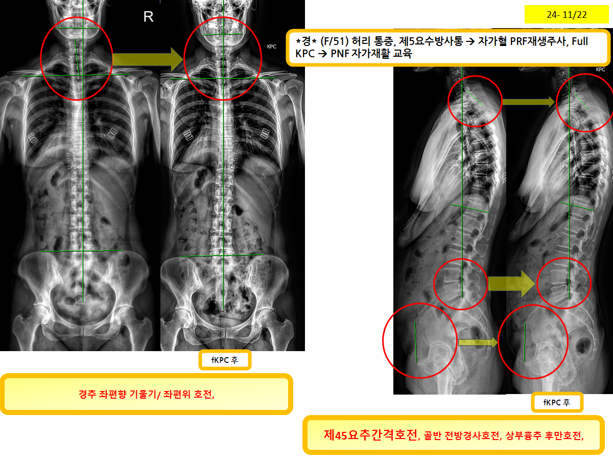 c3b983ddd4d425c7ab76acb26f0d5aae_1772067914_8003.png c3b983ddd4d425c7ab76acb26f0d5aae_1772067914_8003.png