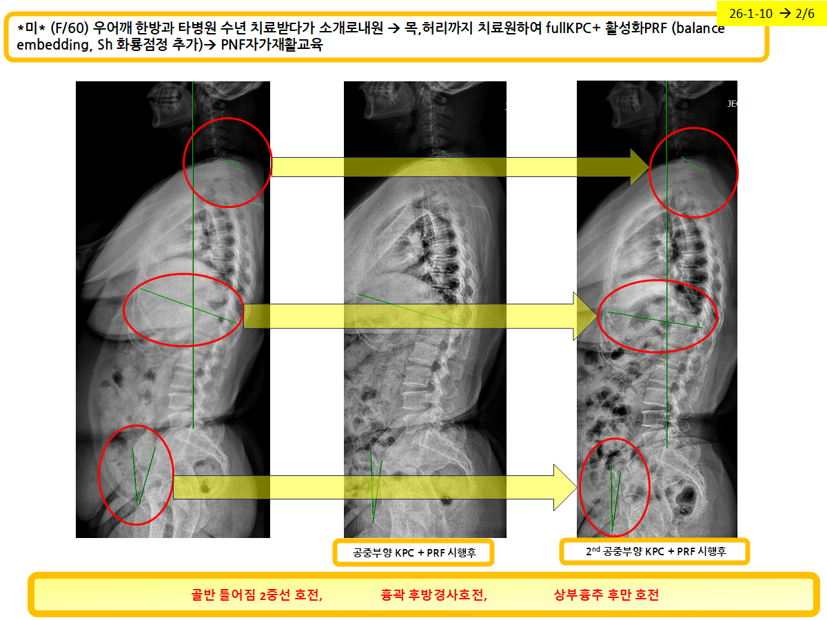 eb94fec42a60e43c954e35c8dbae01de_1770422801_2608.png eb94fec42a60e43c954e35c8dbae01de_1770422801_2608.png