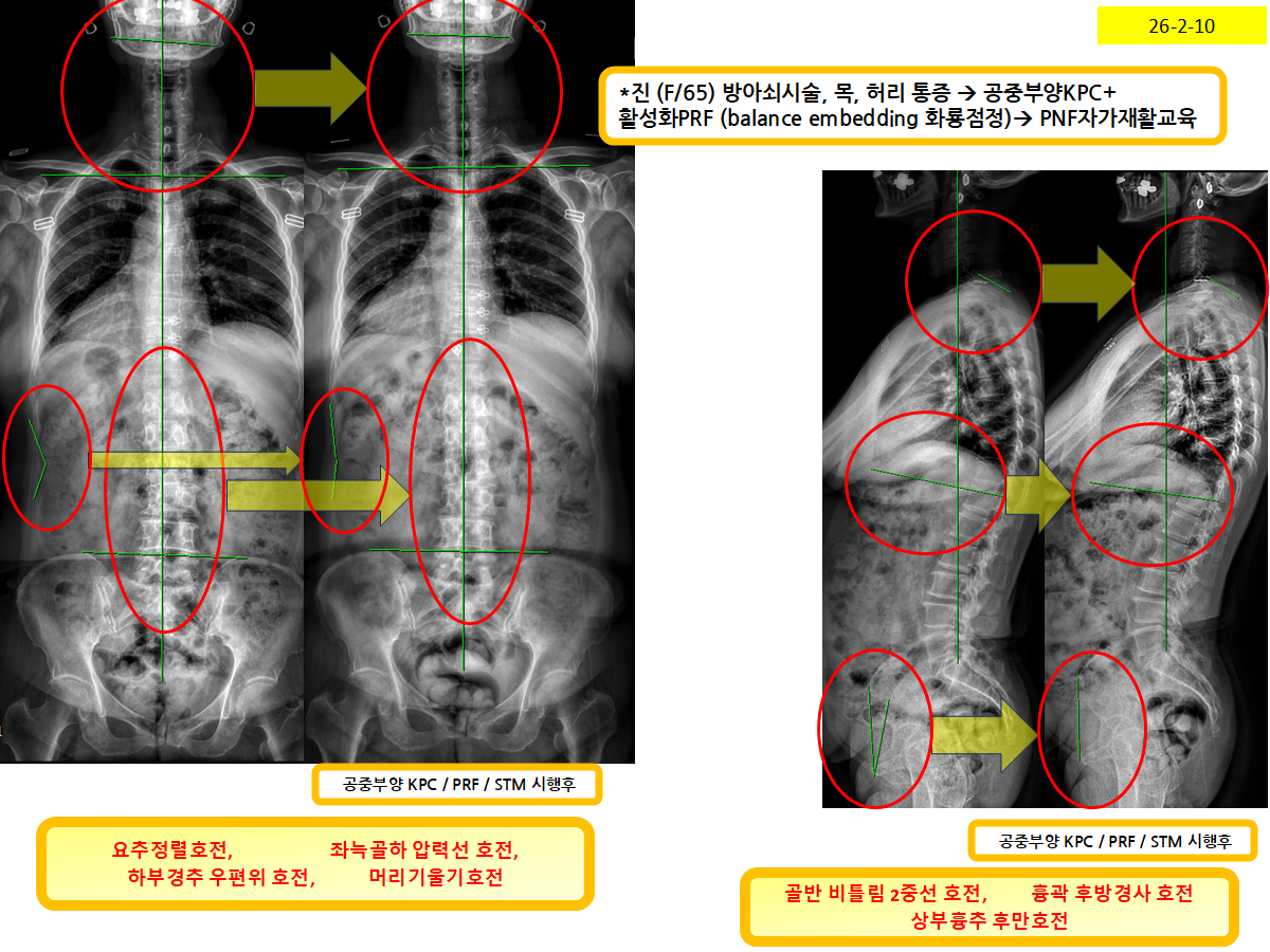 fdcb4f723959aaba70ee17557e34a3c1_1770767520_0946.png