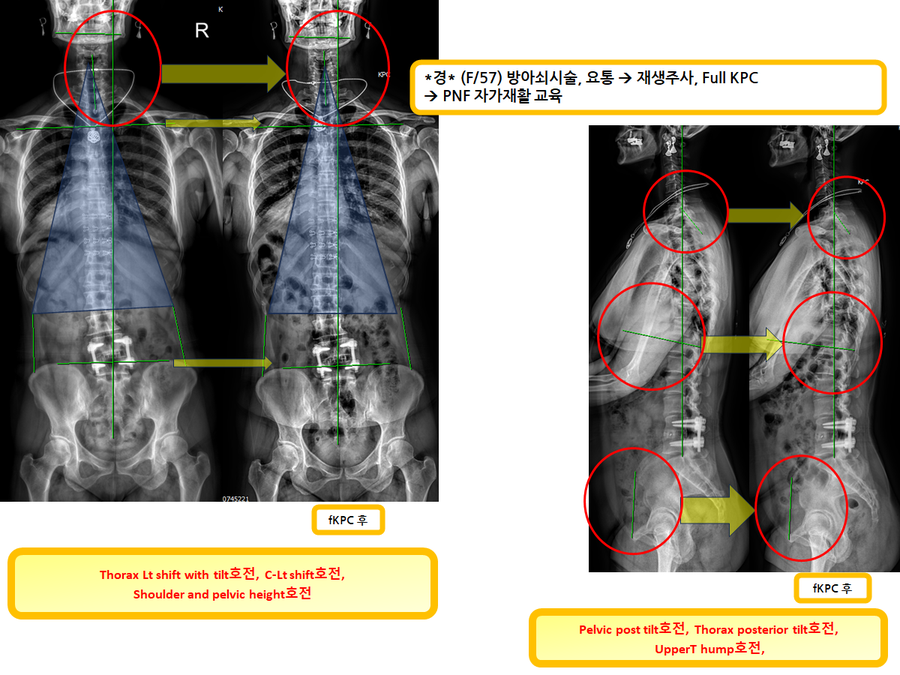 086ab8ae6d41bfea4b5c3ce506b2d6e0_1730538593_9902.png 086ab8ae6d41bfea4b5c3ce506b2d6e0_1730538593_9902.png