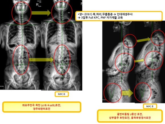 4888e5b358ba89cf607abd88f0a22d9c_1732071051_3798.jpg 4888e5b358ba89cf607abd88f0a22d9c_1732071051_3798.jpg