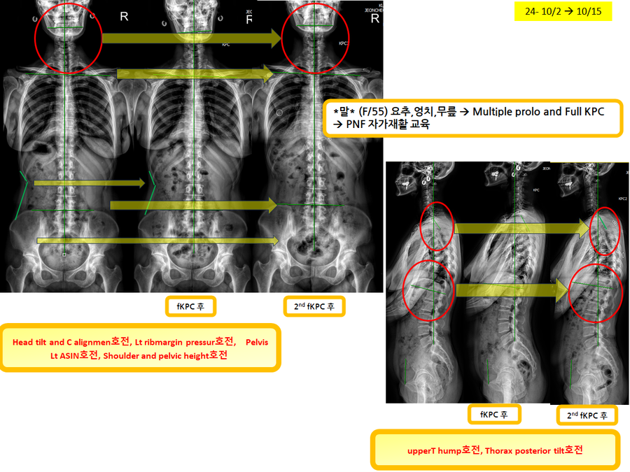 49c45ca9a2b2f24b2ab29e33a0453d9f_1729055240_0578.png 49c45ca9a2b2f24b2ab29e33a0453d9f_1729055240_0578.png