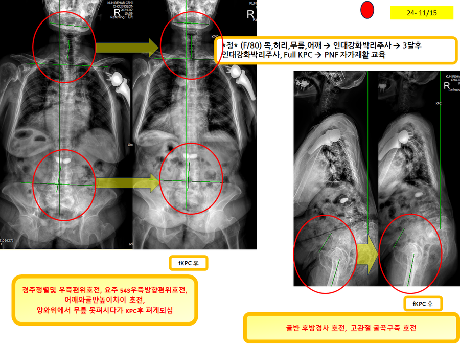 5a7520b91393d6a4c37c36b6dac1d1e8_1731731245_1191.png 5a7520b91393d6a4c37c36b6dac1d1e8_1731731245_1191.png