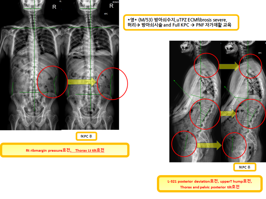 6023e9db8b448a8b4d25db52407c9c58_1728480002_5553.png 6023e9db8b448a8b4d25db52407c9c58_1728480002_5553.png