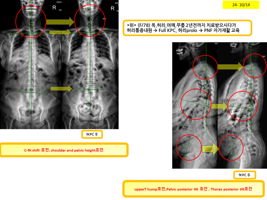 79f3a20910862222b92df96fd2f90076_1728947359_3038.png 79f3a20910862222b92df96fd2f90076_1728947359_3038.png