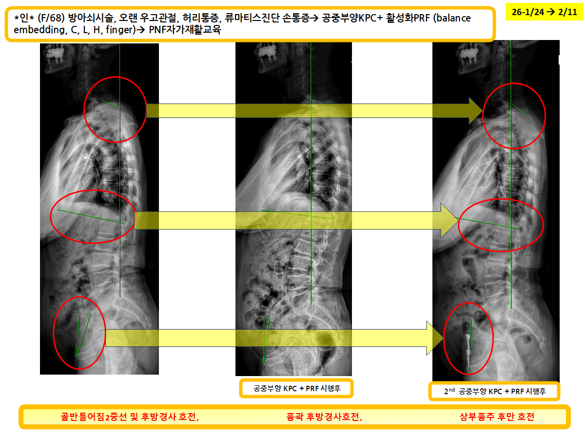7daae232354cc4e81bcdae6f2bd97cd2_1771638955_8605.png 7daae232354cc4e81bcdae6f2bd97cd2_1771638955_8605.png
