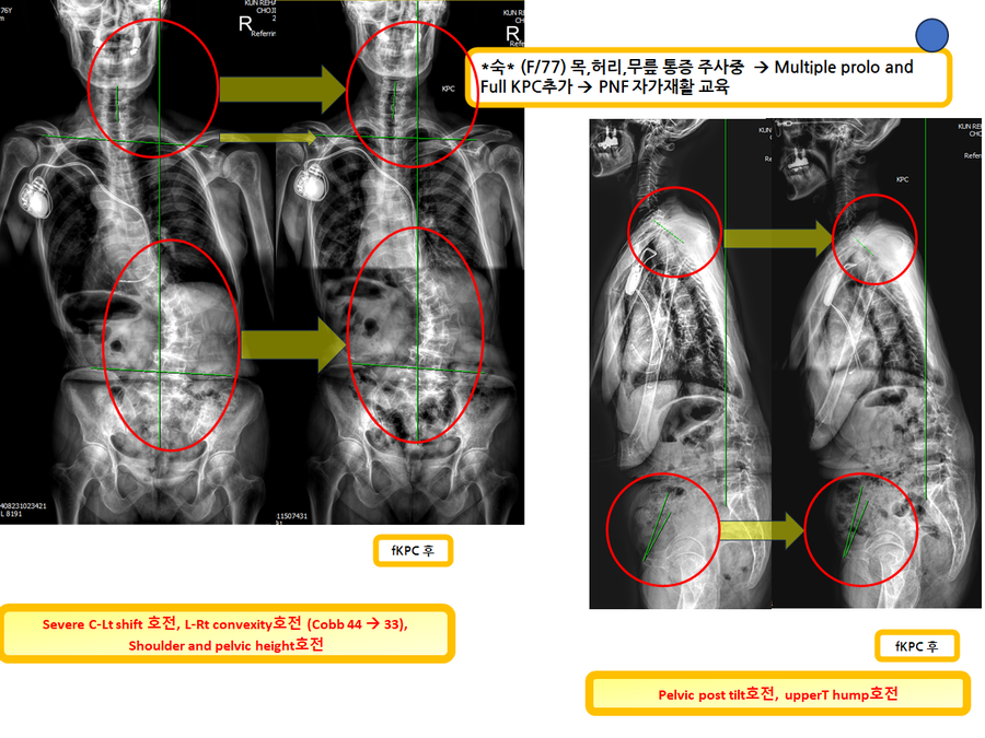 8b744166e25a8725a3bc077c6f847840_1727934094_0723.png 8b744166e25a8725a3bc077c6f847840_1727934094_0723.png