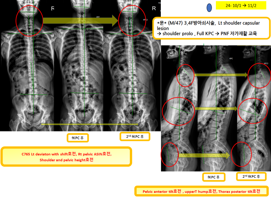 a5ea361becdce3b65a540bd6b2491ff9_1730674207_7813.png a5ea361becdce3b65a540bd6b2491ff9_1730674207_7813.png