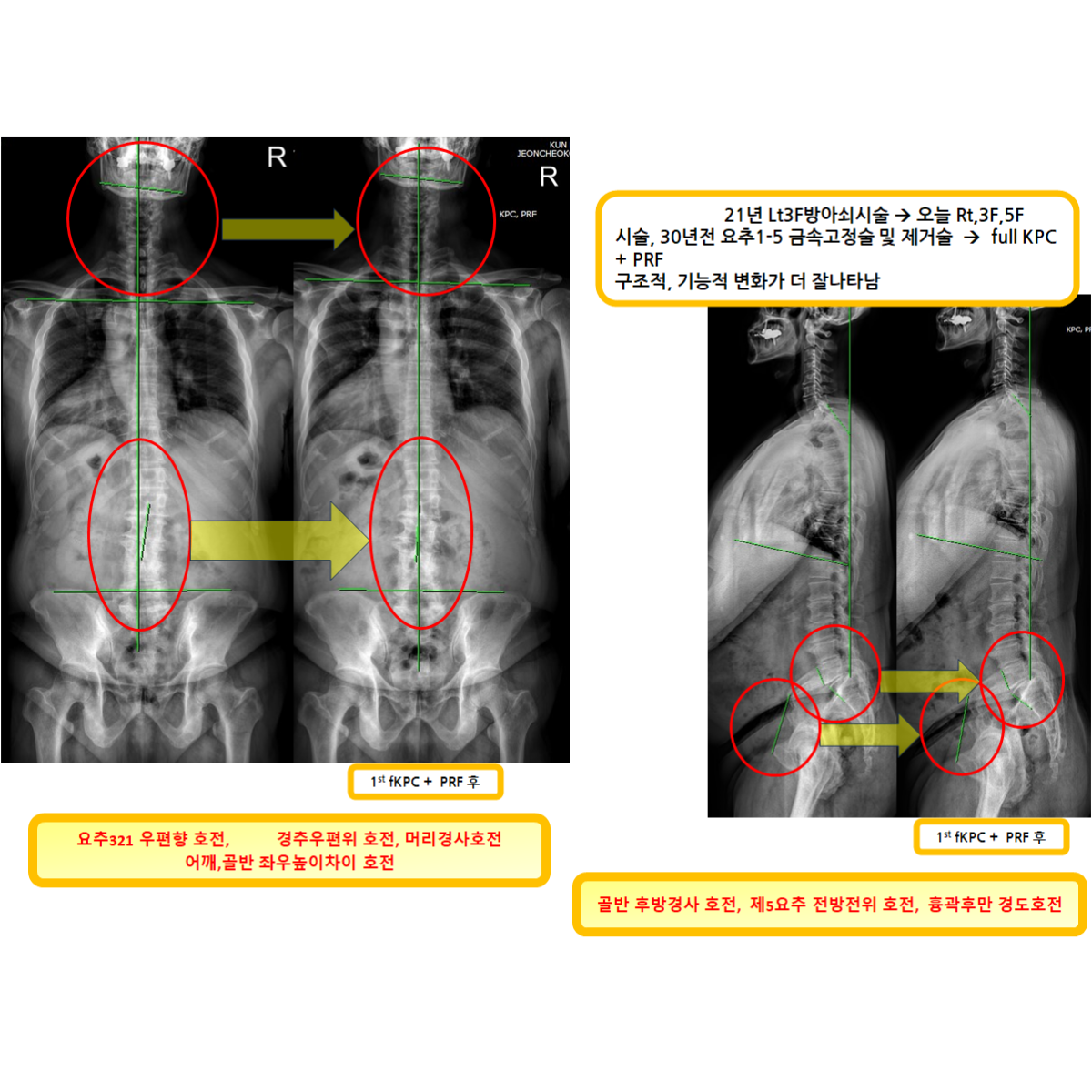 b673327bcc7361cb3f0c25364d6bcc41_1787112013_2002.png