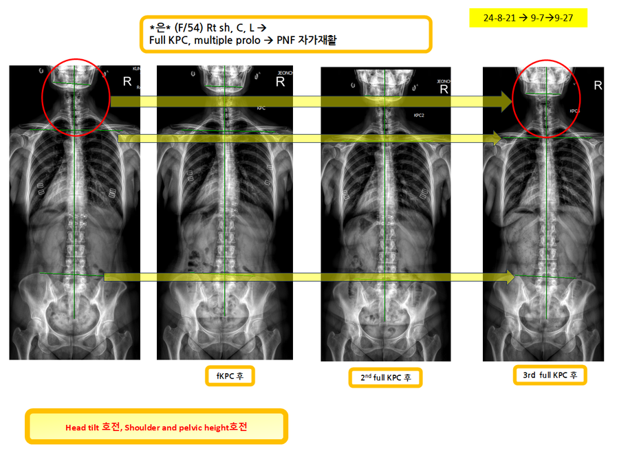 c936d30f0f1044c900be24424b4d4e70_1727448547_9245.png c936d30f0f1044c900be24424b4d4e70_1727448547_9245.png
