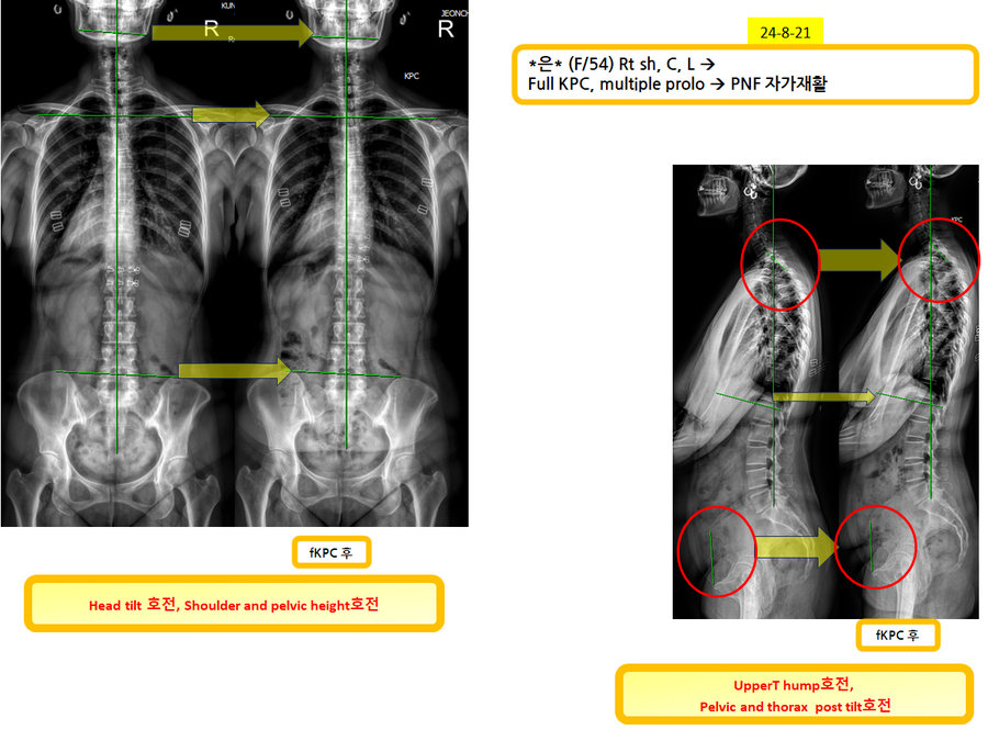 d8d1a95bffefcb384e8468239cc2eac6_1724371765_8176.png d8d1a95bffefcb384e8468239cc2eac6_1724371765_8176.png
