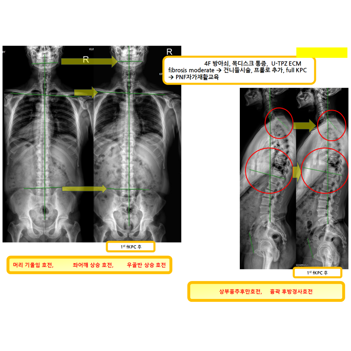 d9fa7482618a6f3667a0f10b56e24139_1787710230_8498.png d9fa7482618a6f3667a0f10b56e24139_1787710230_8498.png