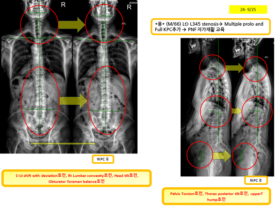 e7b8c93668ef34aab35ad13eb085cdf6_1727350279_4915.png e7b8c93668ef34aab35ad13eb085cdf6_1727350279_4915.png