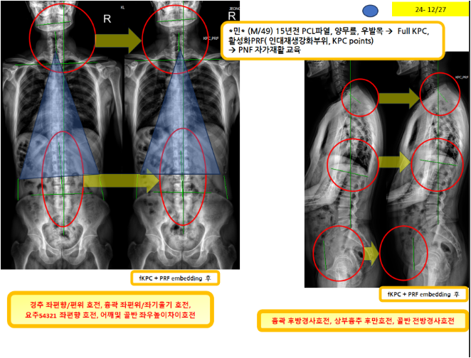 e8594d75d60f4b1d351f12f1183079de_1735525200_0555.png e8594d75d60f4b1d351f12f1183079de_1735525200_0555.png