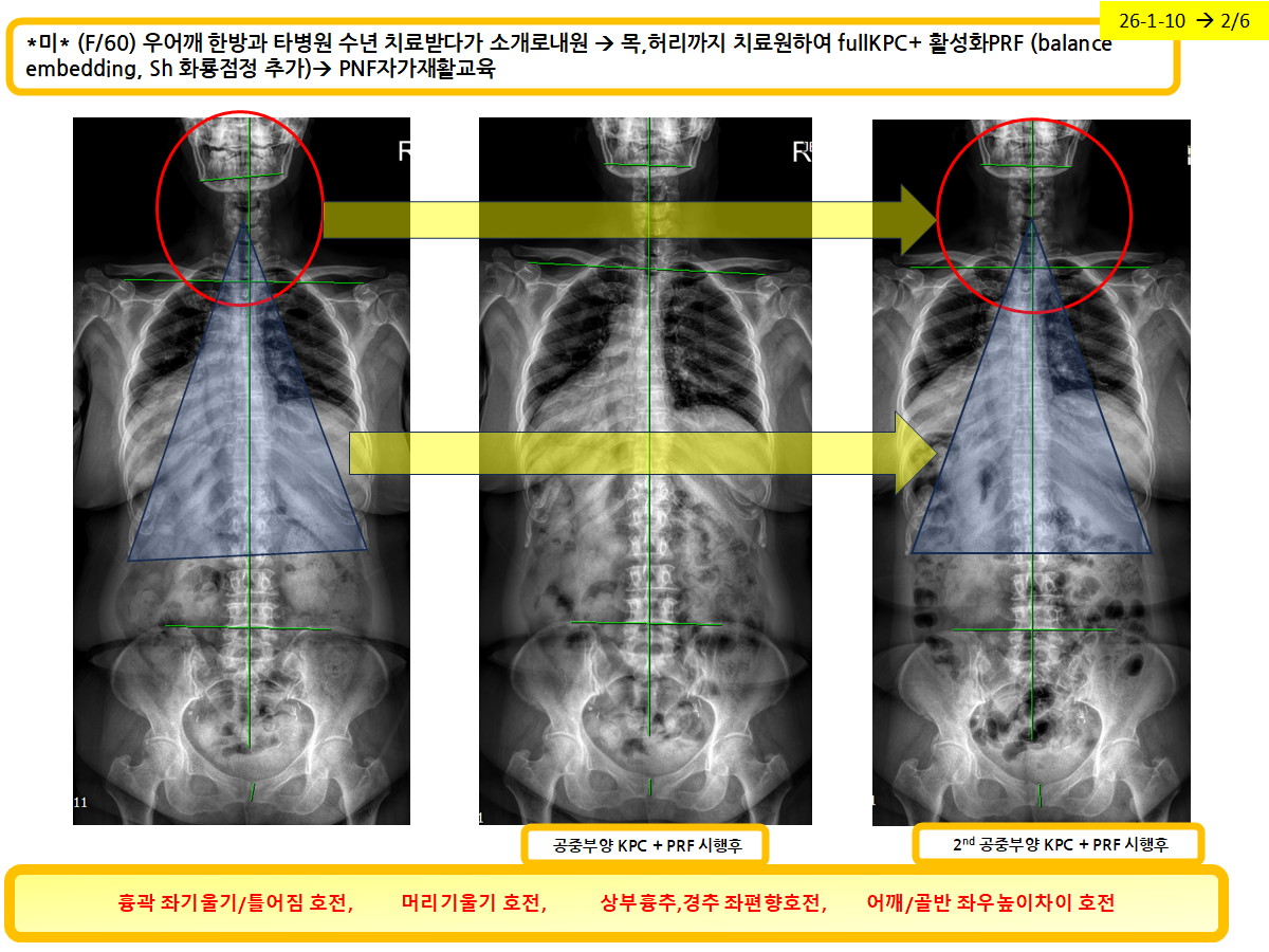 eb94fec42a60e43c954e35c8dbae01de_1770422768_9067.png eb94fec42a60e43c954e35c8dbae01de_1770422768_9067.png