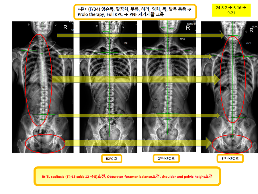 ede1a9af405b844cd29c9b7194239958_1727093914_0455.png ede1a9af405b844cd29c9b7194239958_1727093914_0455.png