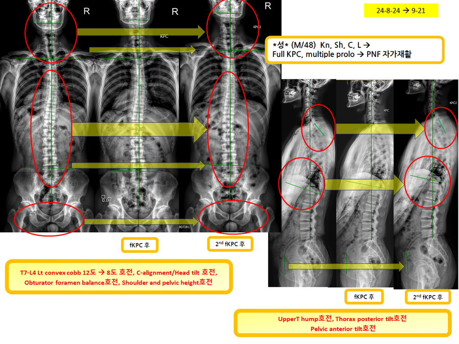 ede1a9af405b844cd29c9b7194239958_1727093914_7496.png ede1a9af405b844cd29c9b7194239958_1727093914_7496.png
