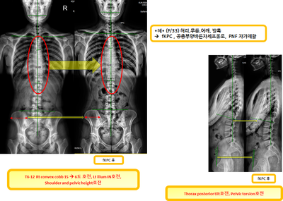 f2d173bc0e92b66f5b847eb42ecd0295_1721088926_3408.png f2d173bc0e92b66f5b847eb42ecd0295_1721088926_3408.png