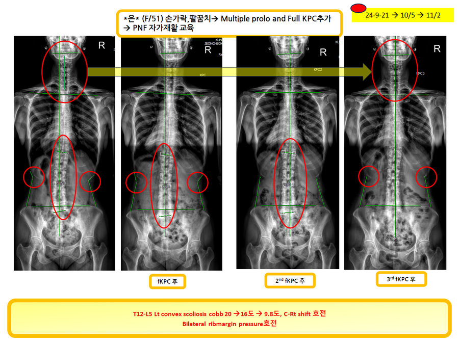 086ab8ae6d41bfea4b5c3ce506b2d6e0_1730538594_2892.png 086ab8ae6d41bfea4b5c3ce506b2d6e0_1730538594_2892.png