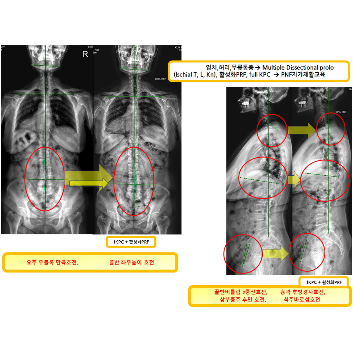 0d7c9ff3cbd685b452e58f1671130851_1791947561_3259.png 0d7c9ff3cbd685b452e58f1671130851_1791947561_3259.png