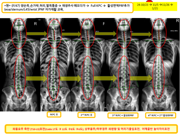 1fb5a3170c08b9e3b46e3b9ba3403f37_1737506070_3287.png 1fb5a3170c08b9e3b46e3b9ba3403f37_1737506070_3287.png