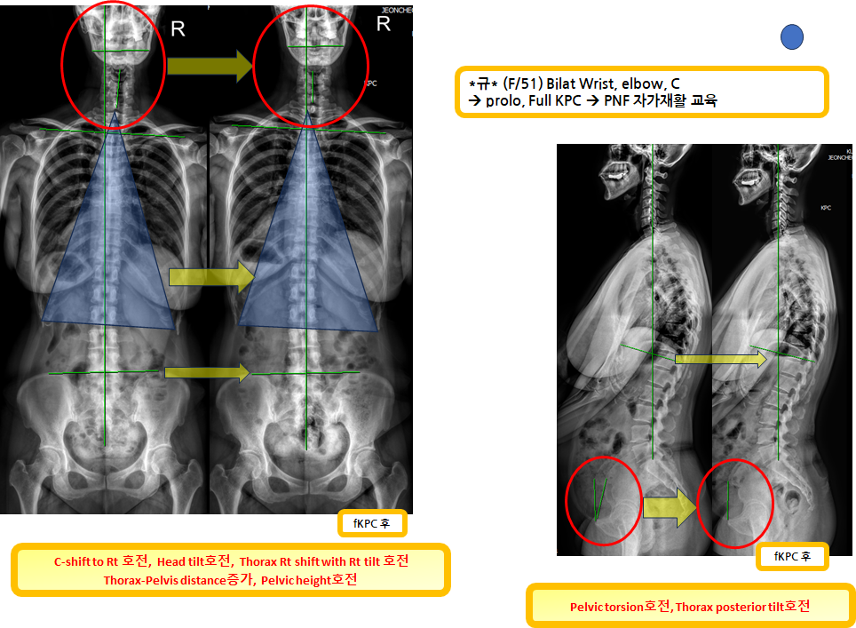 8d6b411ca81781da632d94cdc5d2af9d_1724939523_0345.png 8d6b411ca81781da632d94cdc5d2af9d_1724939523_0345.png