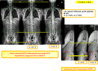 9fda2ad1a320c3444bebfd12b2c8d497_1720154920_2188.png 9fda2ad1a320c3444bebfd12b2c8d497_1720154920_2188.png