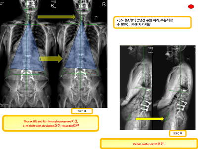 9fda2ad1a320c3444bebfd12b2c8d497_1720154920_3287.png 9fda2ad1a320c3444bebfd12b2c8d497_1720154920_3287.png