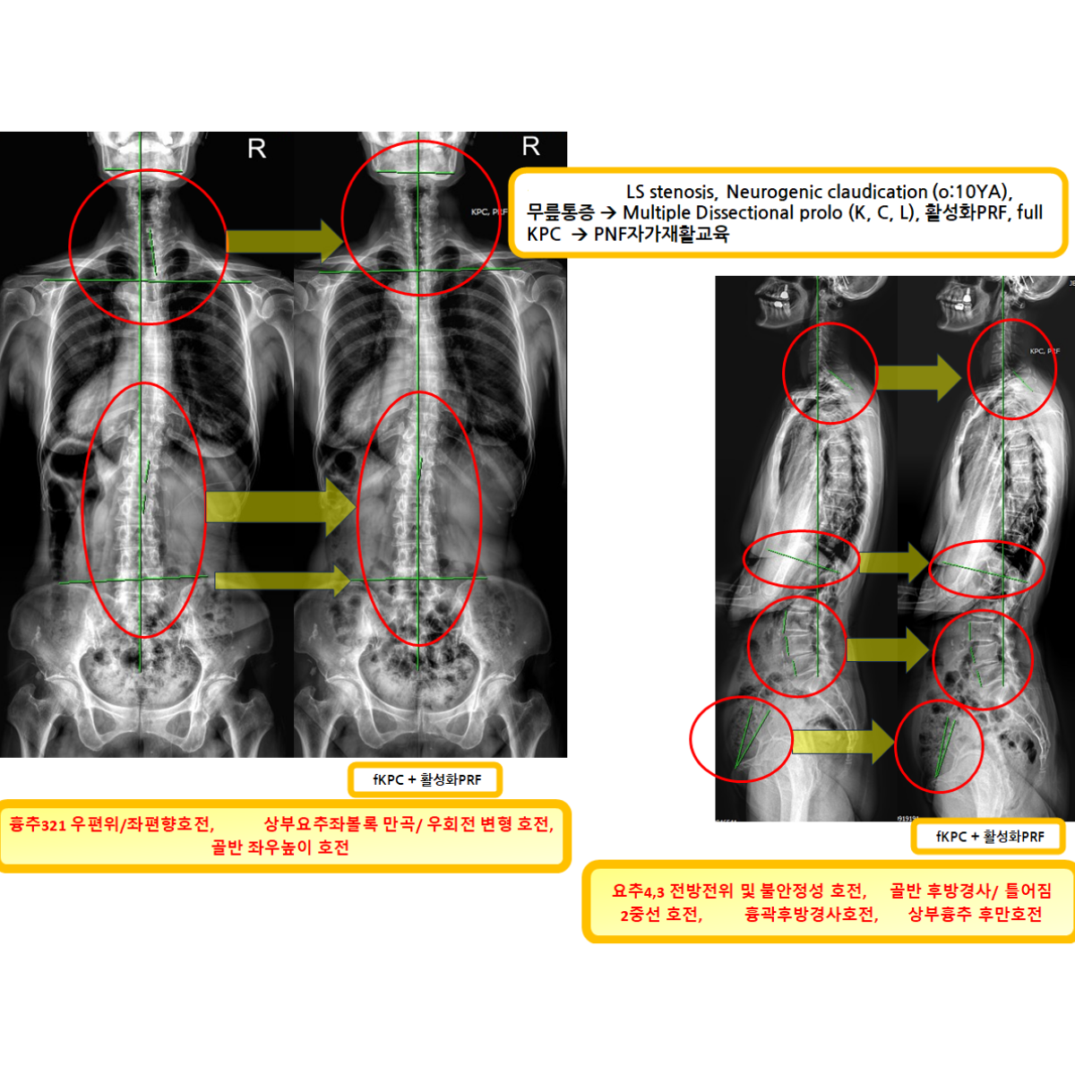 a304364cdd71081e9143ebe73d4f5c96_1793233936_2518.png a304364cdd71081e9143ebe73d4f5c96_1793233936_2518.png