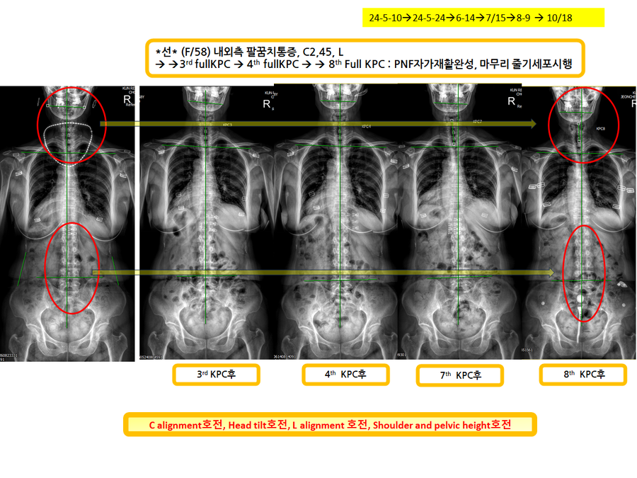 a90707af0bf9109d35f53a878a3b30a9_1729259728_0757.png a90707af0bf9109d35f53a878a3b30a9_1729259728_0757.png
