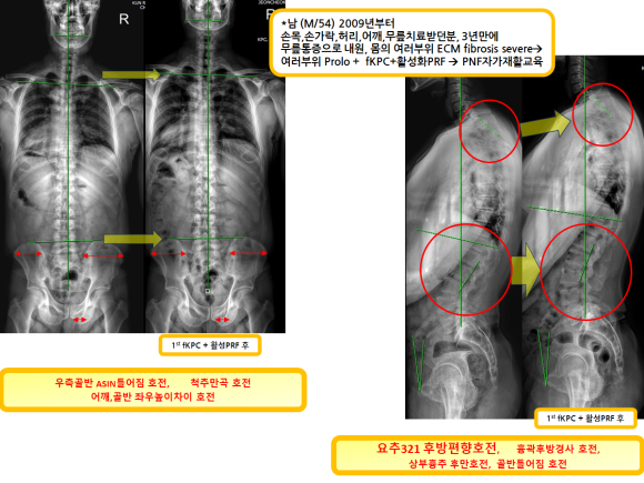 aa784ea17edc863366b2154e6cd7d870_1739839915_1622.png aa784ea17edc863366b2154e6cd7d870_1739839915_1622.png