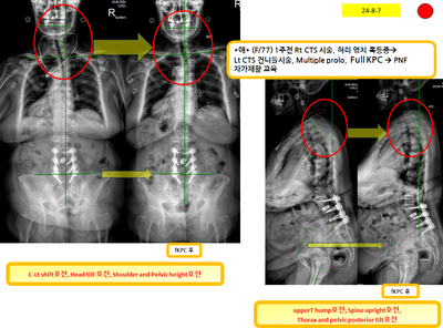 ac11a5eb25b829abedc1e98a9b9bba34_1723185414_4877.png ac11a5eb25b829abedc1e98a9b9bba34_1723185414_4877.png