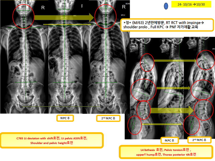 c7770bcb77f848c020d2602c1fc08a67_1730345147_2562.png c7770bcb77f848c020d2602c1fc08a67_1730345147_2562.png