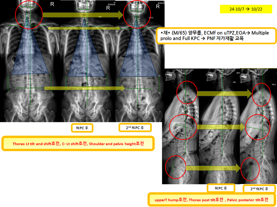 cdfae4f987335e4edbfaada3a5579f03_1729604171_9567.png cdfae4f987335e4edbfaada3a5579f03_1729604171_9567.png