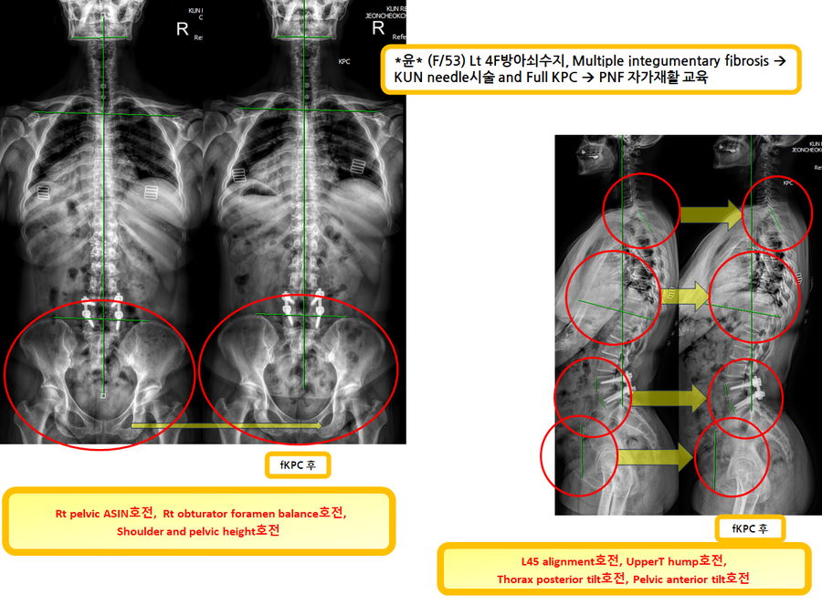 e7b766fa389d2c44016c131746a9a3fc_1728752305_0261.png e7b766fa389d2c44016c131746a9a3fc_1728752305_0261.png