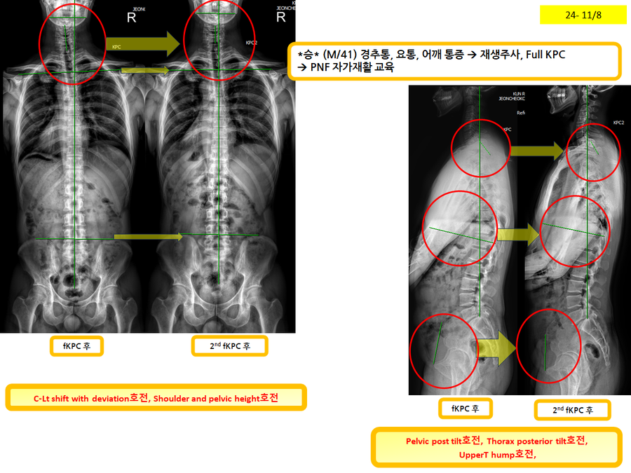 eb226a0319bd9fc6497f208093e77d5a_1731113213_5593.png eb226a0319bd9fc6497f208093e77d5a_1731113213_5593.png
