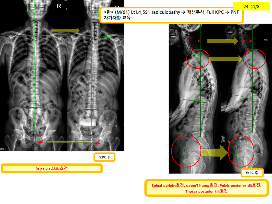 eb226a0319bd9fc6497f208093e77d5a_1731113213_6814.png eb226a0319bd9fc6497f208093e77d5a_1731113213_6814.png