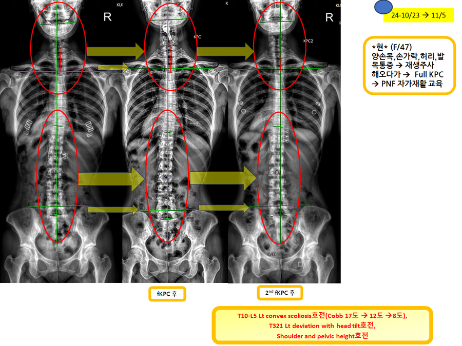 f11704035bd1efca18ea0f20569e4117_1730848597_8258.png f11704035bd1efca18ea0f20569e4117_1730848597_8258.png